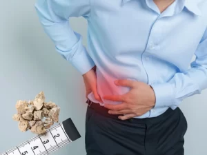 Kidney Stones: Causes, Symptoms & Prevention With Natural Remedies by Healthy Indian Solutions