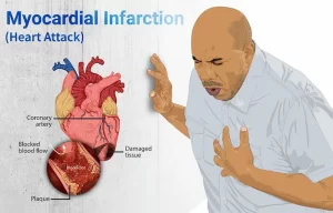Heart Attack: Symptoms, Signs & Prevention Tips You Must Know by healthyindiansolutions
