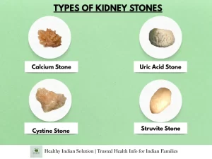 Kidney Stones: Causes, Symptoms & Prevention With Natural Remedies by Healthy Indian Solutions