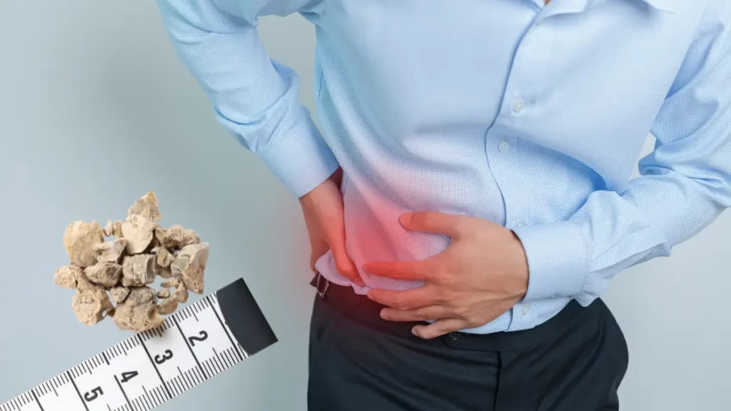 Kidney Stones: Causes, Symptoms & Prevention blog by Healthy Indian Solutions