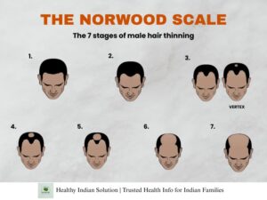 Hair Thinning Guide Blog by Healthy Indian Solutions
